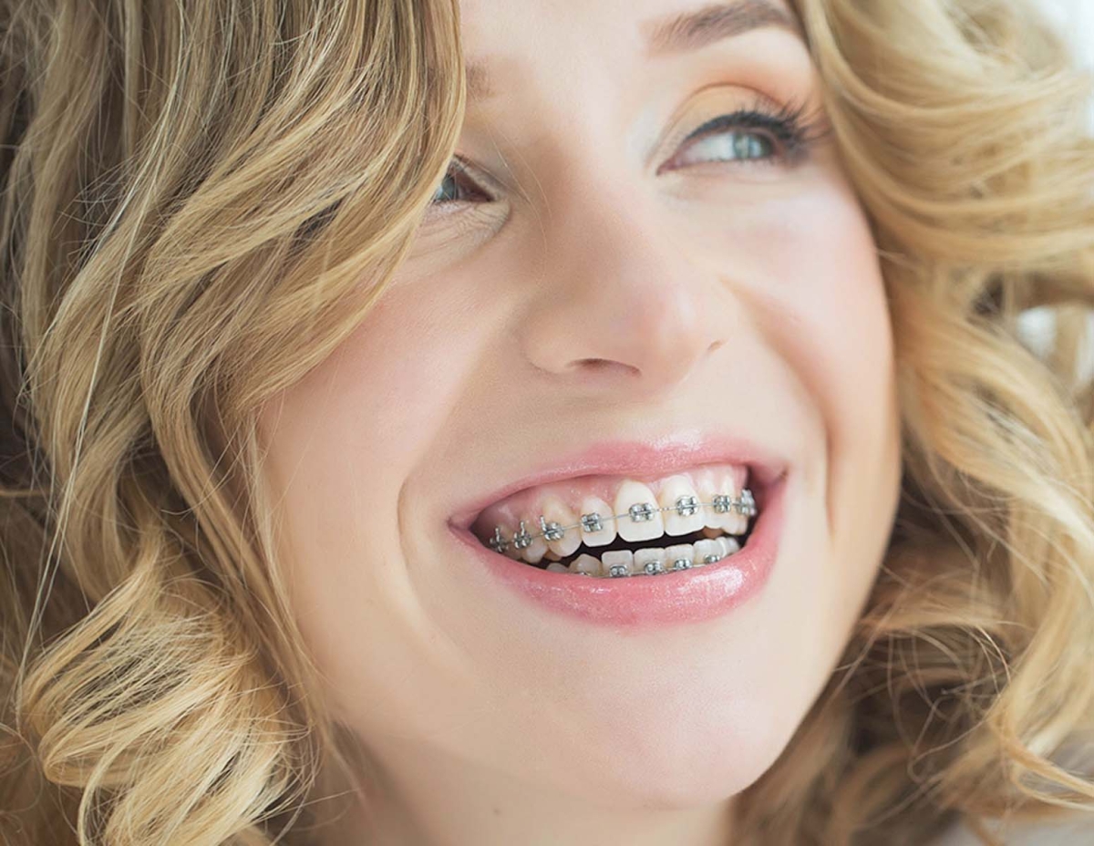Orthodontic Treatment for Adults Allenwood NJ
